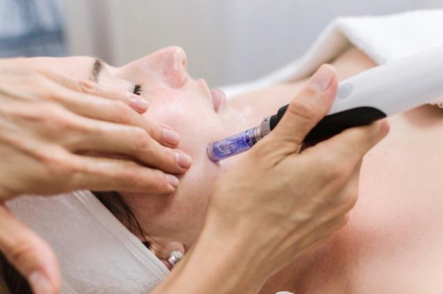 Microneedling